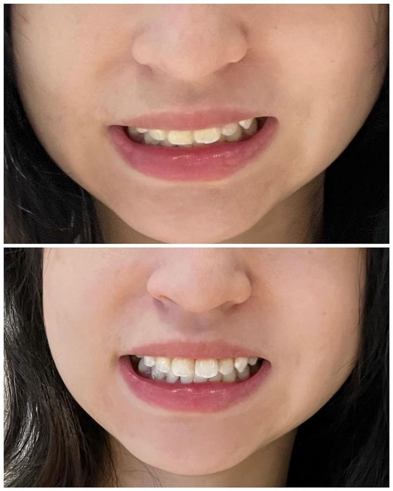 「好來全亮白組合」牙齒保健第一品牌、深層潔淨、明亮煥白、專為美齒而生！