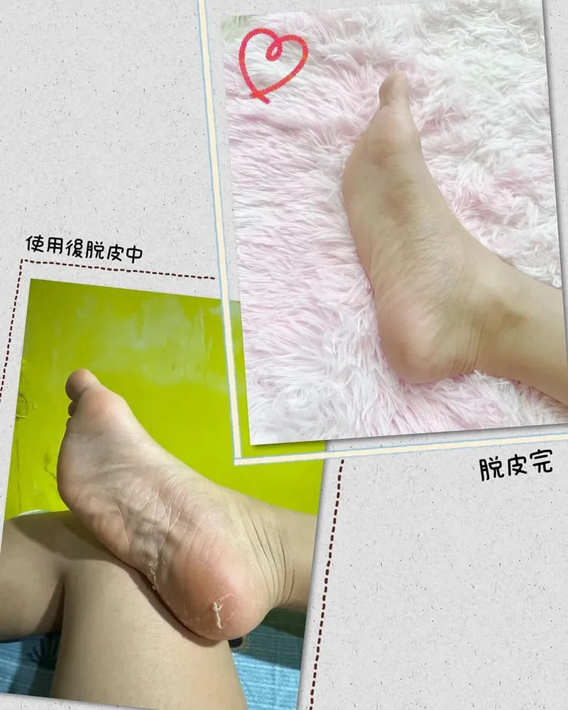「雪芙蘭美足膜法」拋光修護、深層保濕、重現嬌嫩細膩美足、女性美麗小秘密!